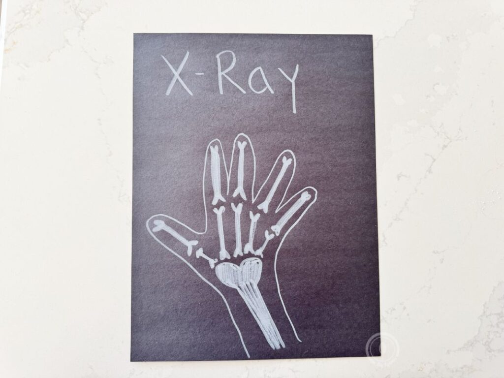 Letter X is for X-ray white crayon and black paper tracing idea for preschoolers and kindergarteners learning Letter X